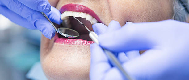 Best Emergency Dental Extractions in Briggs, OK